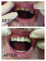 Heasley Dental image 4